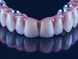 Venice Implant Dentistry & Laser